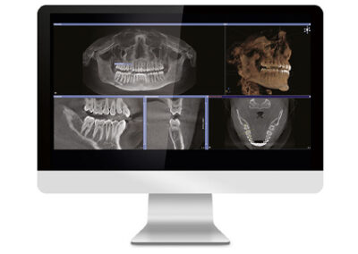 3-D X-Rays on computer screen